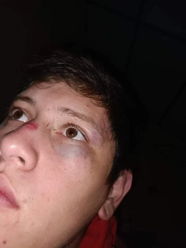 El fuerte relato del delivery que fue golpeado por un empresario posadeño 