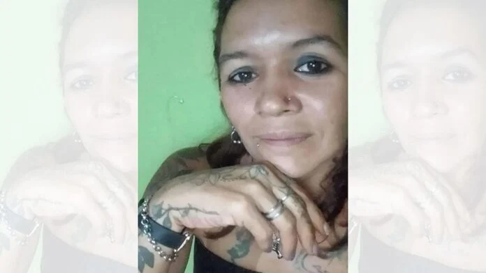 Norma Maidana pelea por su vida: tiene más del 70% del cuerpo quemado 